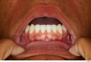 Garson teeth 0003.jpg